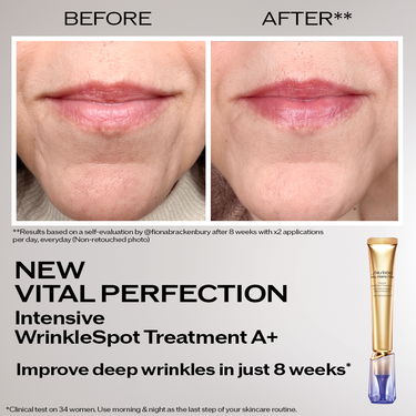 Intensive Wrinklespot Treatment A+, 