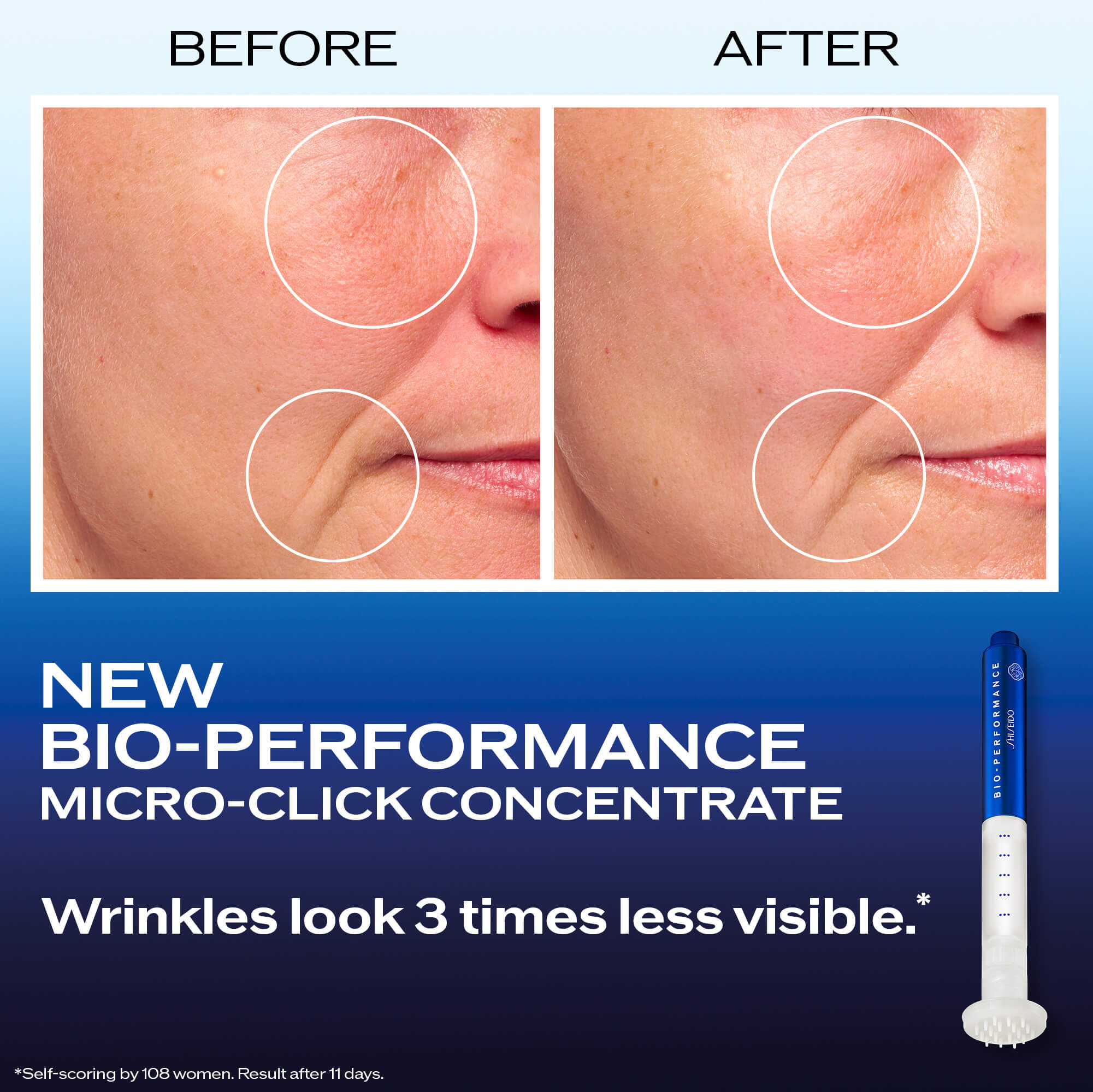 Bio-Performance Micro-Click Concentrate | SHISEIDO