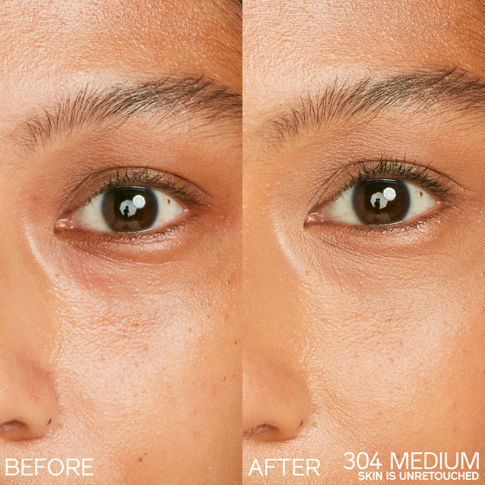 Synchro Skin Radiant Lifting Concealer, Moyen 304