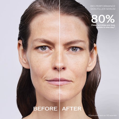 Before and after comparison from using the skin filler serum 